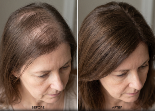 before and after 1