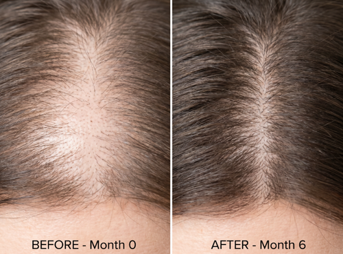 before and after 2