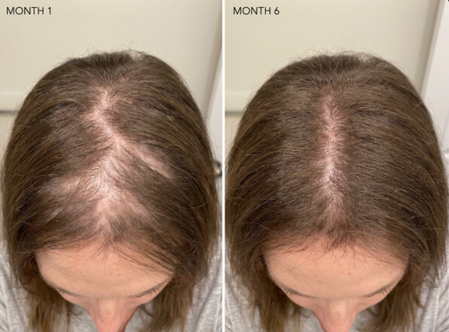before and after 3