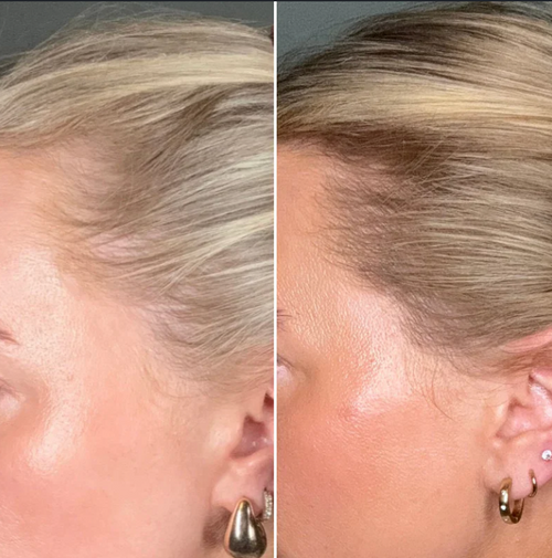 before and after 5